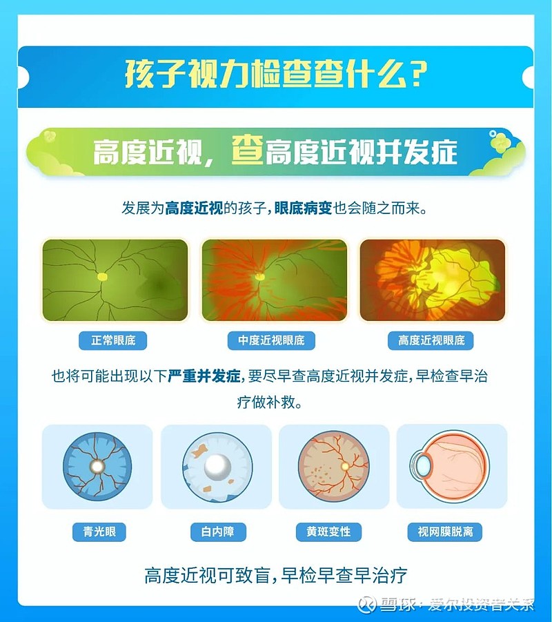 “四查一建档”近视防控全过程管理(图1)