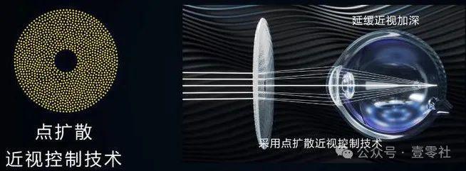 九游娱乐：点扩散技术镜片一年见效？和多点离焦相比谁能更好控制孩子近视眼(图2)