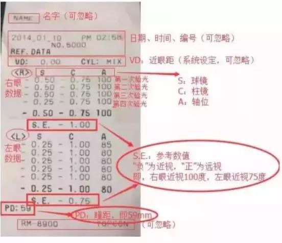 九游娱乐：配眼镜如何看懂验光单？(图1)