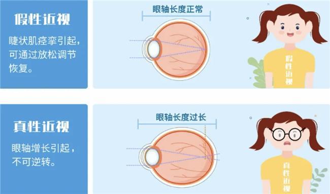 孩子近视防控该怎么做？爱尔眼科这3招一定要学会(图2)