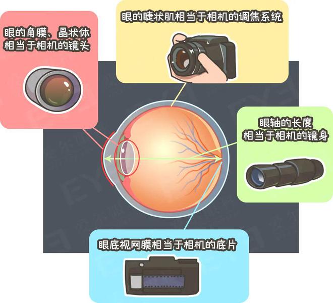 九游娱乐NineGame：近视真的不能恢复吗？这篇文章说明白了(图1)