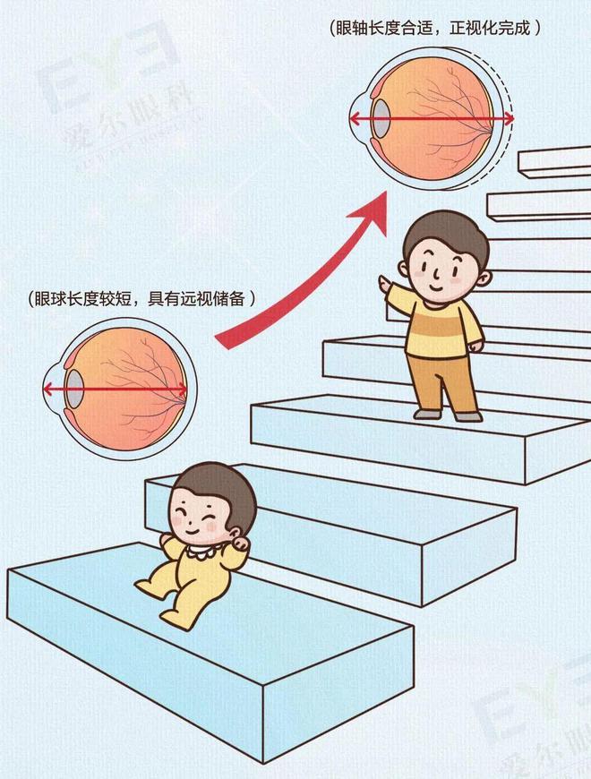 九游娱乐NineGame：近视真的不能恢复吗？这篇文章说明白了(图3)