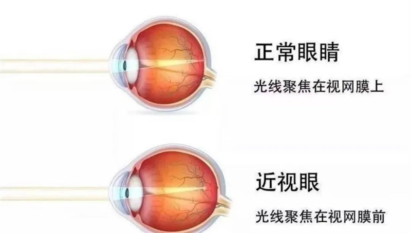 九游娱乐NineGame：有效减少近视发生共同守护光明未来——第8个全国近视防控宣传教育月(图1)