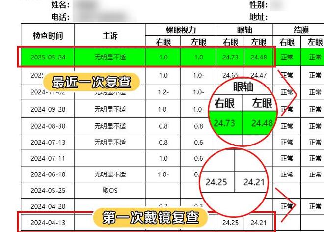 10岁女孩精准近视防控！就靠佛山爱尔OK镜+阿托品“双管齐下”！(图2)
