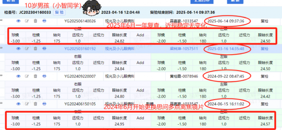 思问多点离焦镜——“近视防控神器”江门爱尔新希望助力青少年近视防控(图2)