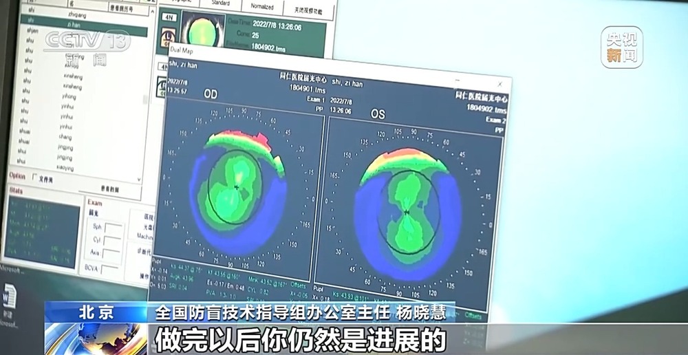 暑期当心视力“滑坡”这份护眼指南请收好(图7)