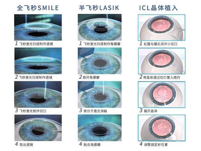 九游娱乐NineGame：近视600度不仅是戴眼镜那么简单！贵港华厦爱眼给高度近视建议(图2)
